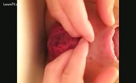 Scat anal prolapse action
