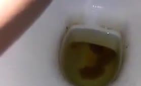 Hairy lady peeing and pooping