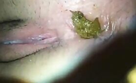 Hot closeup of yellow creamy poop 