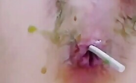 Asian girl scat anal candy  