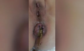 Amateur pooping asshole closeup 
