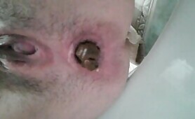 Pushing hard turd closeup 