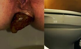 Hairy ass and hot turd 