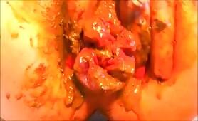 Milf plays with her pulsating anus after prolapse