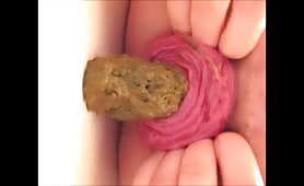 Milf shits with prolapsed anus closeup