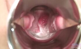 Asian Woman Smears Shit on Her Pussy and Pisses